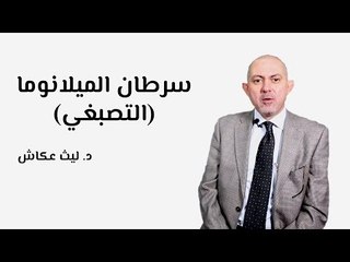 سرطان الجلد الميلانوما (التصبغي)