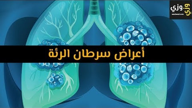 أهم أعراض سرطان الرئة