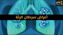 أهم أعراض سرطان الرئة