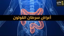أهم أعراض سرطان القولون