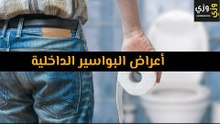 أهم أعراض البواسير الداخلية