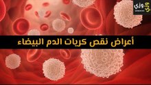 أهم أعراض نقص كريات الدم البيضاء