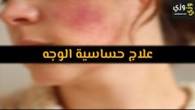 أهم علاج حساسية الوجه