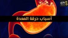 أهم أسباب حرقة المعدة