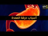 أهم أسباب حرقة المعدة