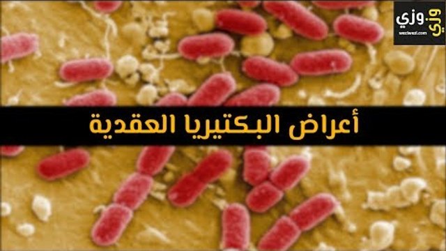 أهم أعراض البكتيريا العقدية