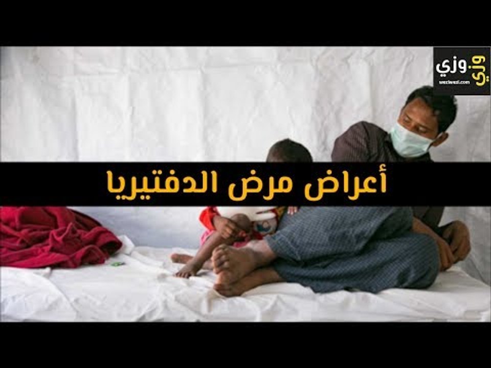 أهم أعراض مرض الدفتيريا