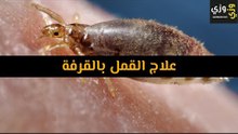 أهم علاج القمل بالقرفة