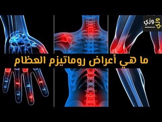 أهم ما هي أعراض روماتيزم العظام