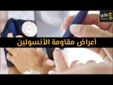 أهم أعراض مقاومة الأنسولين