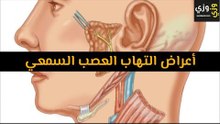 أهم أعراض التهاب العصب السمعي