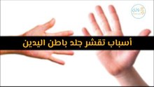 أهم أسباب تقشر جلد باطن اليدين