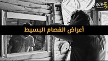 أهم أعراض الفصام البسيط