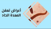 أهم أعراض تعفن المعدة الحاد