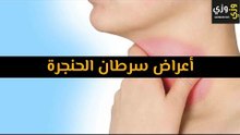 أهم أعراض سرطان الحنجرة