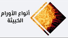 أهم أنواع الأورام الخبيثة