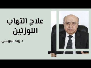 علاج التهاب اللوزتين عند الكبار والصغار