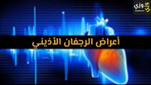 أهم أعراض الرجفان الأذيني