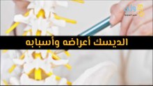 أهم أسباب الديسك وأعراضه