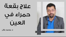 علاج بقعة حمراء في بياض العين