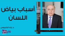 أسباب بياض اللسان