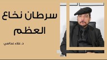 سرطان نخاع العظم