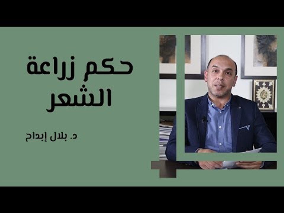 حكم زراعة الشعر