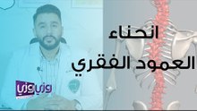 انحناء العمود الفقري