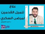 علاج تنميل القدمين لمرضى السكري