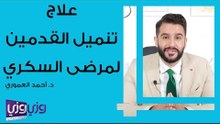 علاج تنميل القدمين لمرضى السكري