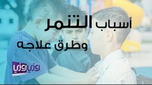 أسباب التنمر وطرق علاجه