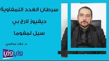 سرطان الغدد اللمفاوية: دفيوز لارج بي سيل لمفوما