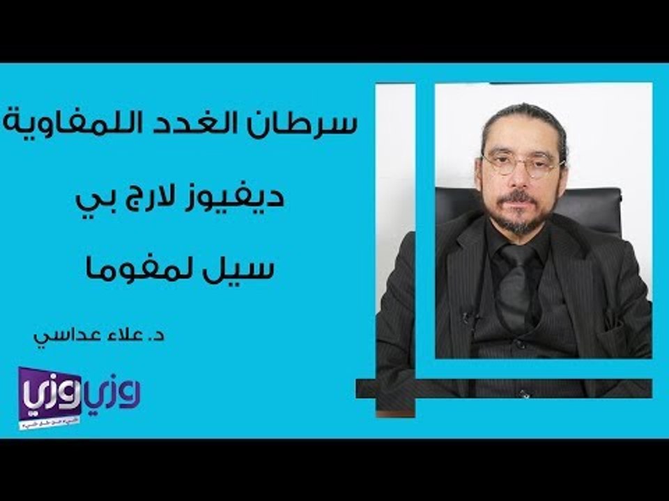 سرطان الغدد اللمفاوية: دفيوز لارج بي سيل لمفوما