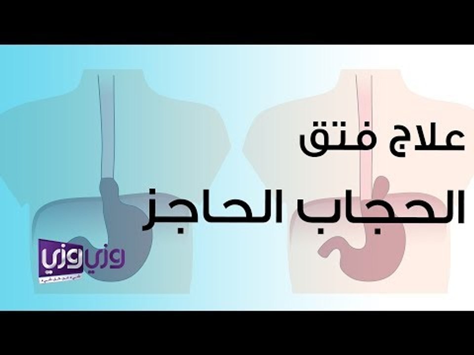 علاج فتق الحجاب الحاجز