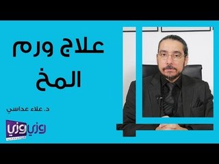 علاج ورم المخ