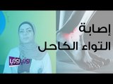 درجات إصابة التواء الكاحل وطريقة علاجه