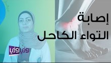 درجات إصابة التواء الكاحل وطريقة علاجه