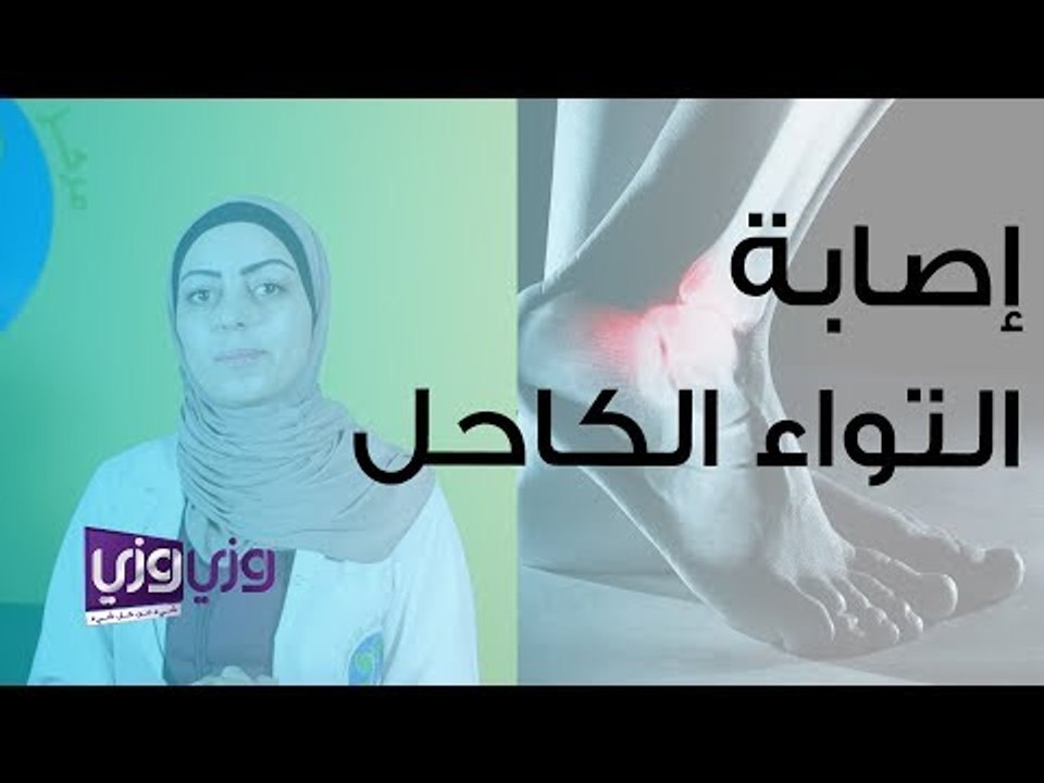 درجات إصابة التواء الكاحل وطريقة علاجه