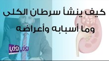 كيف ينشأ سرطان الكلى وما أسبابه وأعراضه