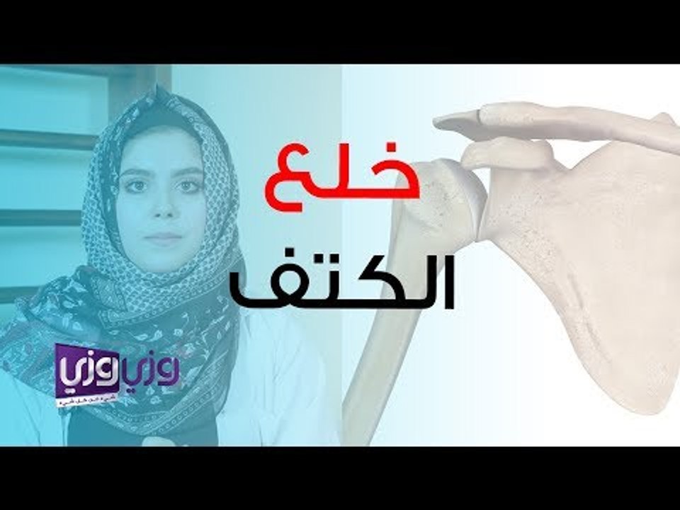 علاج خلع مفصل الكتف طبيعياً
