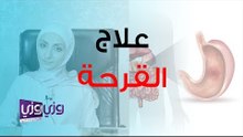 علاج قرحة المعدة