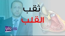 ما هو ثقب القلب وتأثيراته