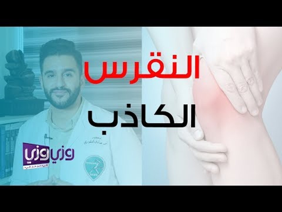 ما هو النقرس الكاذب وما علاجه
