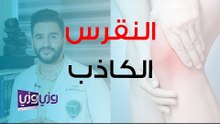 ما هو النقرس الكاذب وما علاجه