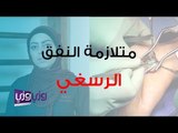 علاج متلازمة النفق الرسغي طبيعياً