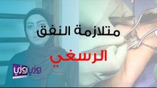 علاج متلازمة النفق الرسغي طبيعياً