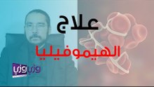 كيف يمكن علاج مرض الهيموفيليا