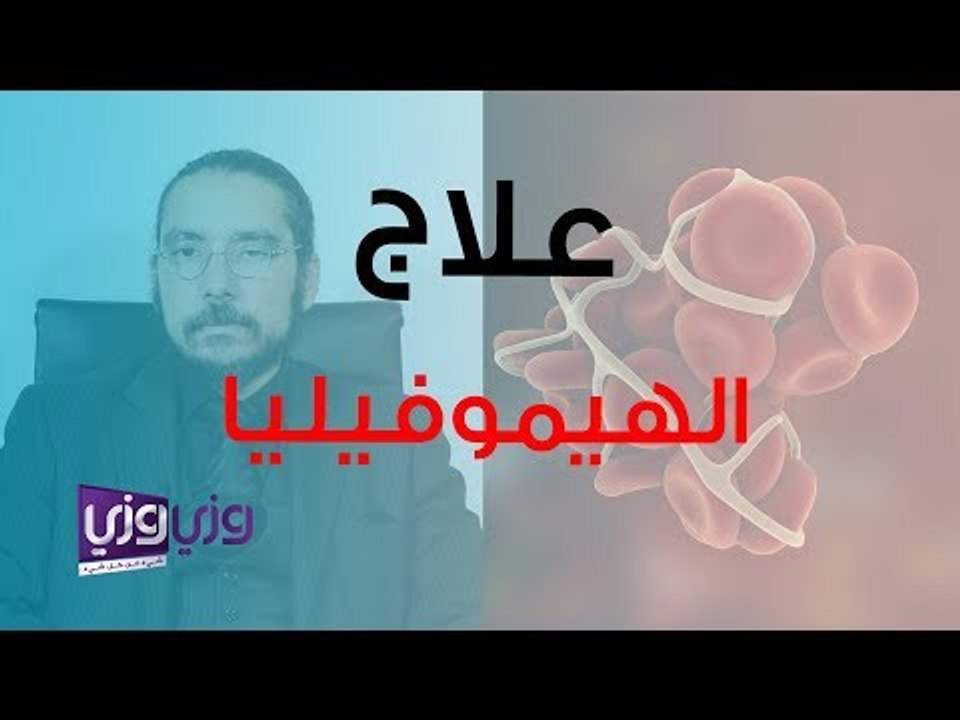كيف يمكن علاج مرض الهيموفيليا