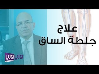 طرق علاج جلطة الساق