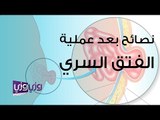 نصائح بعد عملية الفتق السري